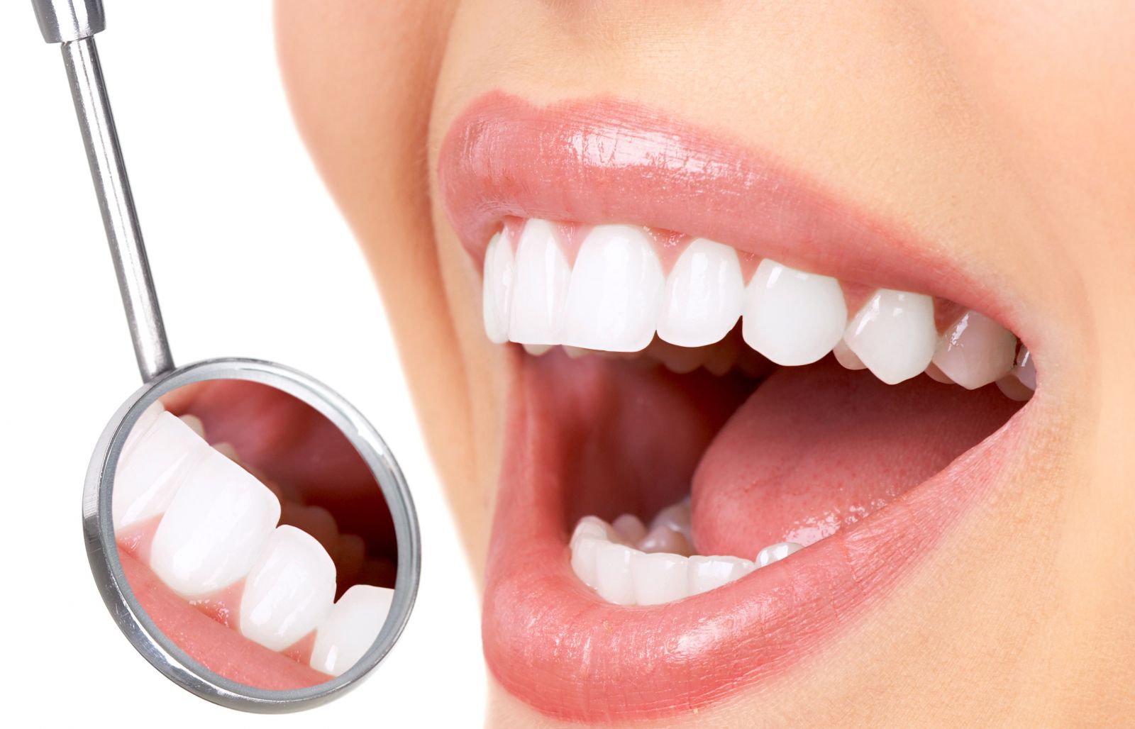 diş beyazlatma yöntemleri 1